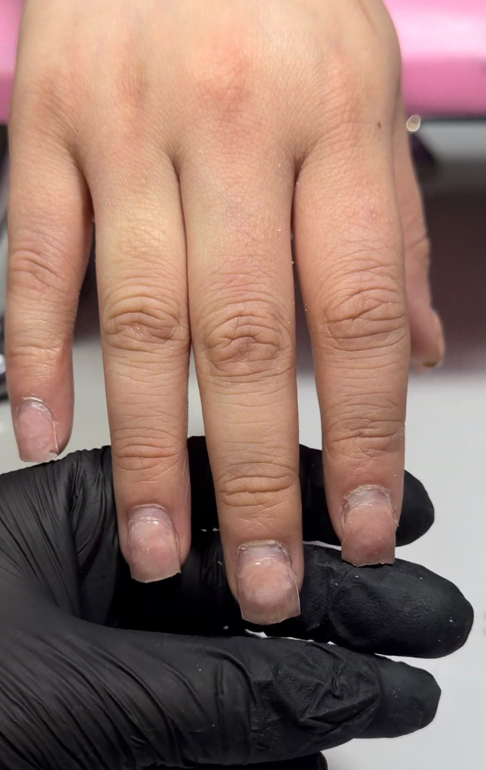 Antes — retiro de uñas acrilicas